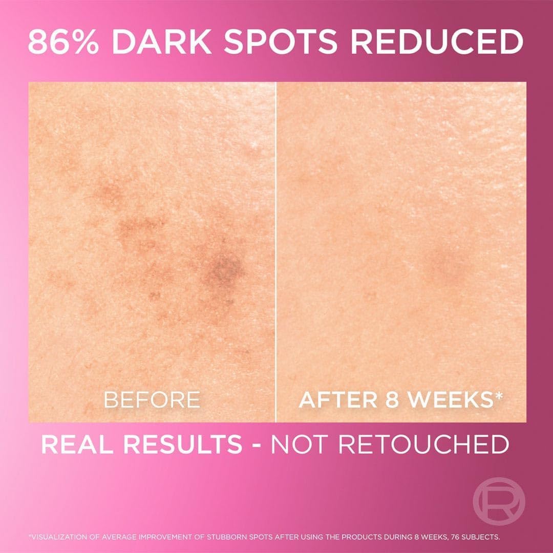 Refect Beauty L'Oreal Paris Glycolic Bright Serum before and after skin comparison showing dark spot reduction