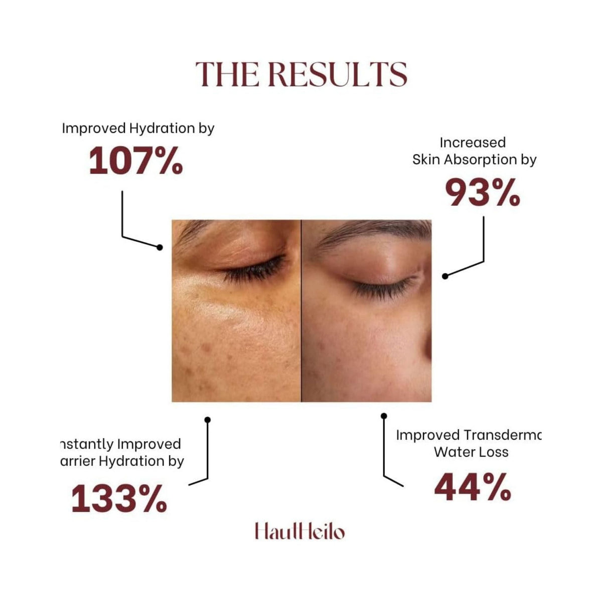 Refect Beauty HautHeilo soothing cream before and after results showing improved skin hydration and barrier repair.