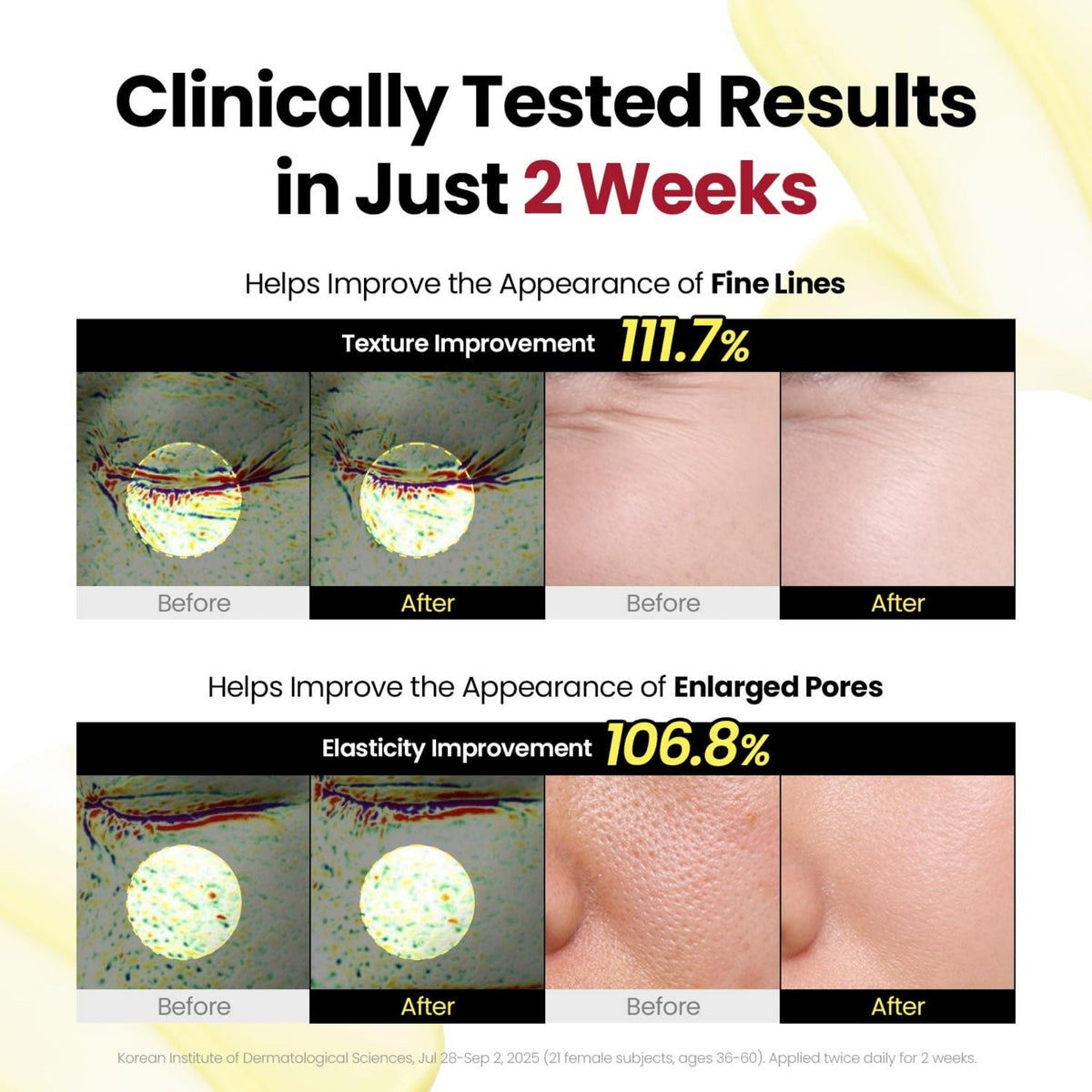 Refect Beauty K-Secret Seoul 1988 Serum clinical results showing before and after skin texture and pore improvement