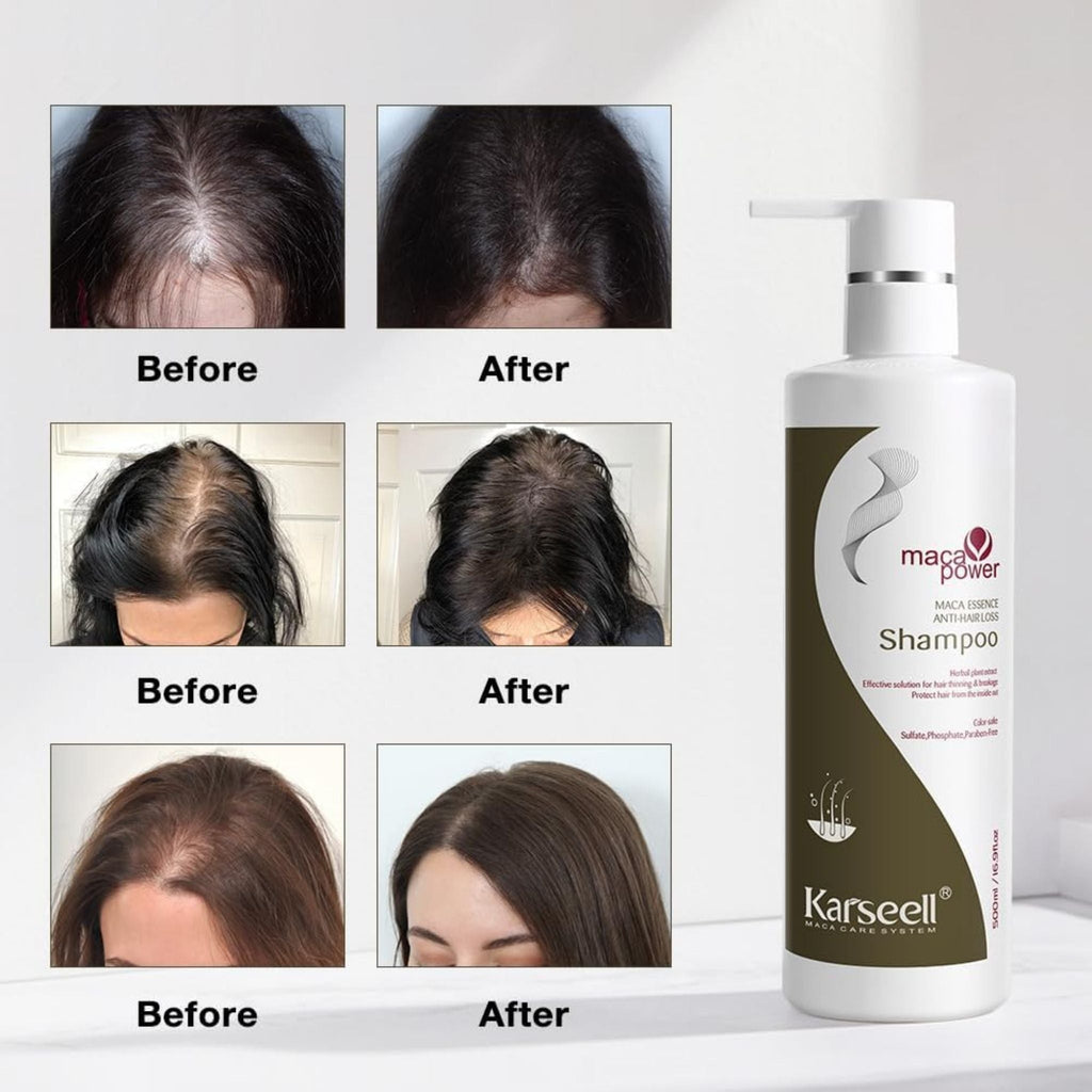 Refect Beauty Karseell Maca Power anti-hair loss shampoo bottle with before and after hair growth comparison photos
