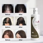 Refect Beauty Karseell Maca Power anti-hair loss shampoo bottle with before and after hair growth comparison photos