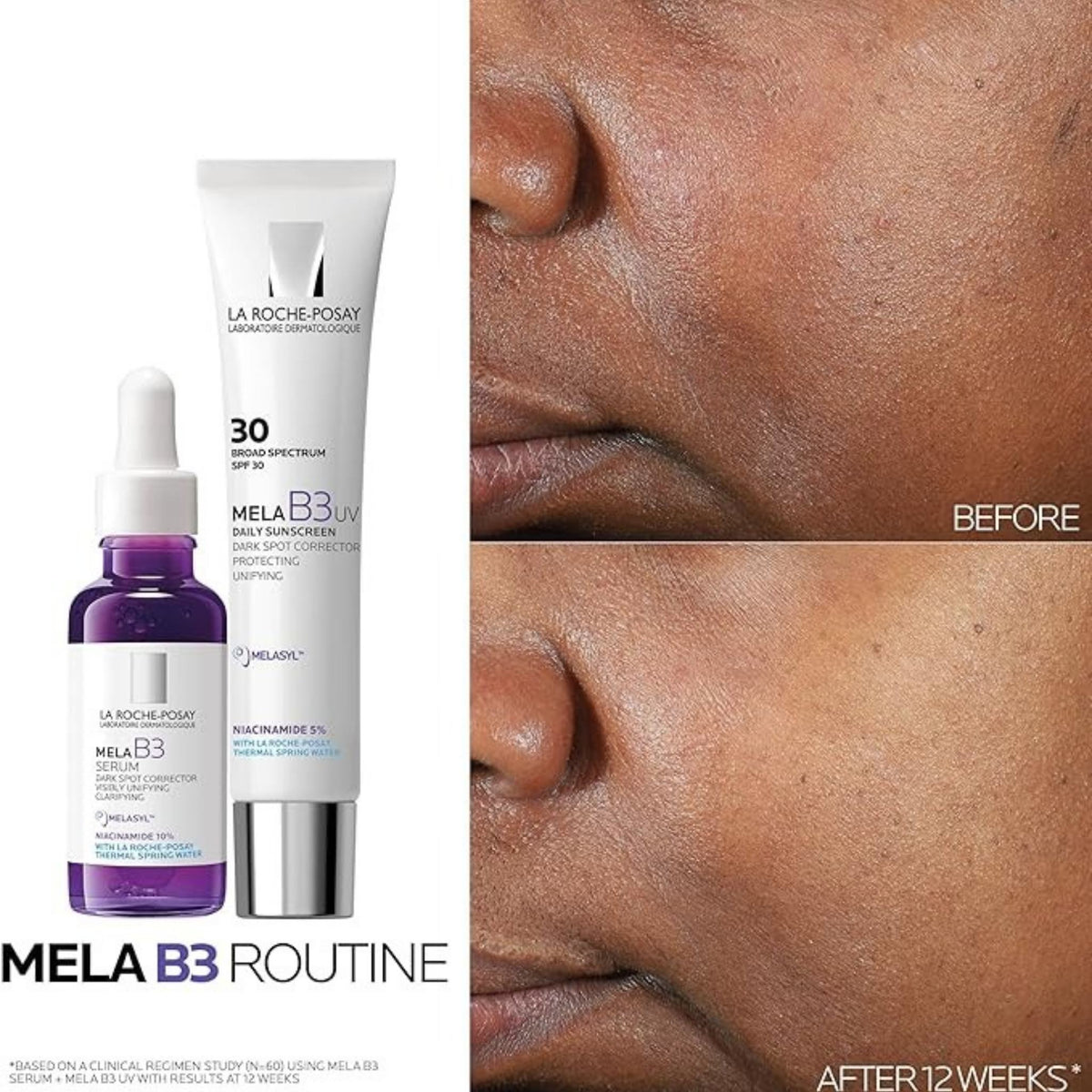 Refect Beauty La Roche Posay Mela B3 serum and SPF moisturizer routine showing skin before and after 12 weeks of use