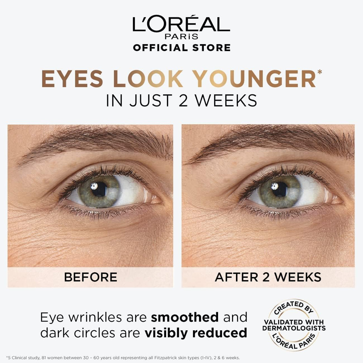 Refect Beauty L'Oreal Paris Hyaluron Expert Eye Serum before and after results showing reduced wrinkles and dark circles