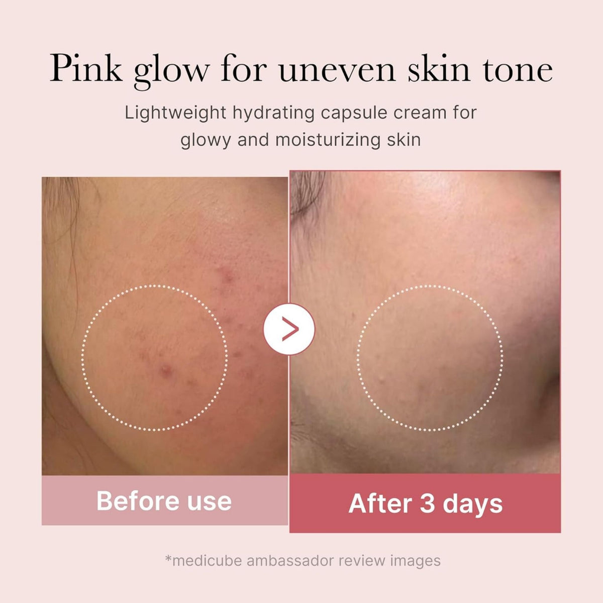 Refect Beauty Medicube PDRN Pink Collagen Capsule Cream before and after skin improvement results
