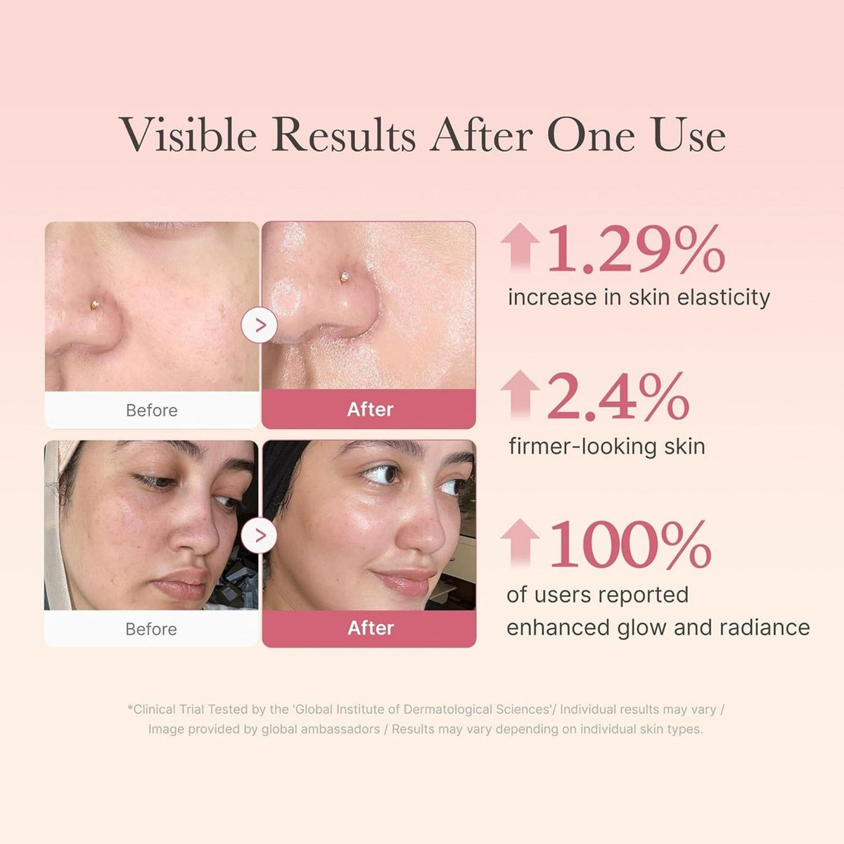 Refect Beauty Medicube Collagen Jelly Cream before and after clinical trial results showing improved skin elasticity