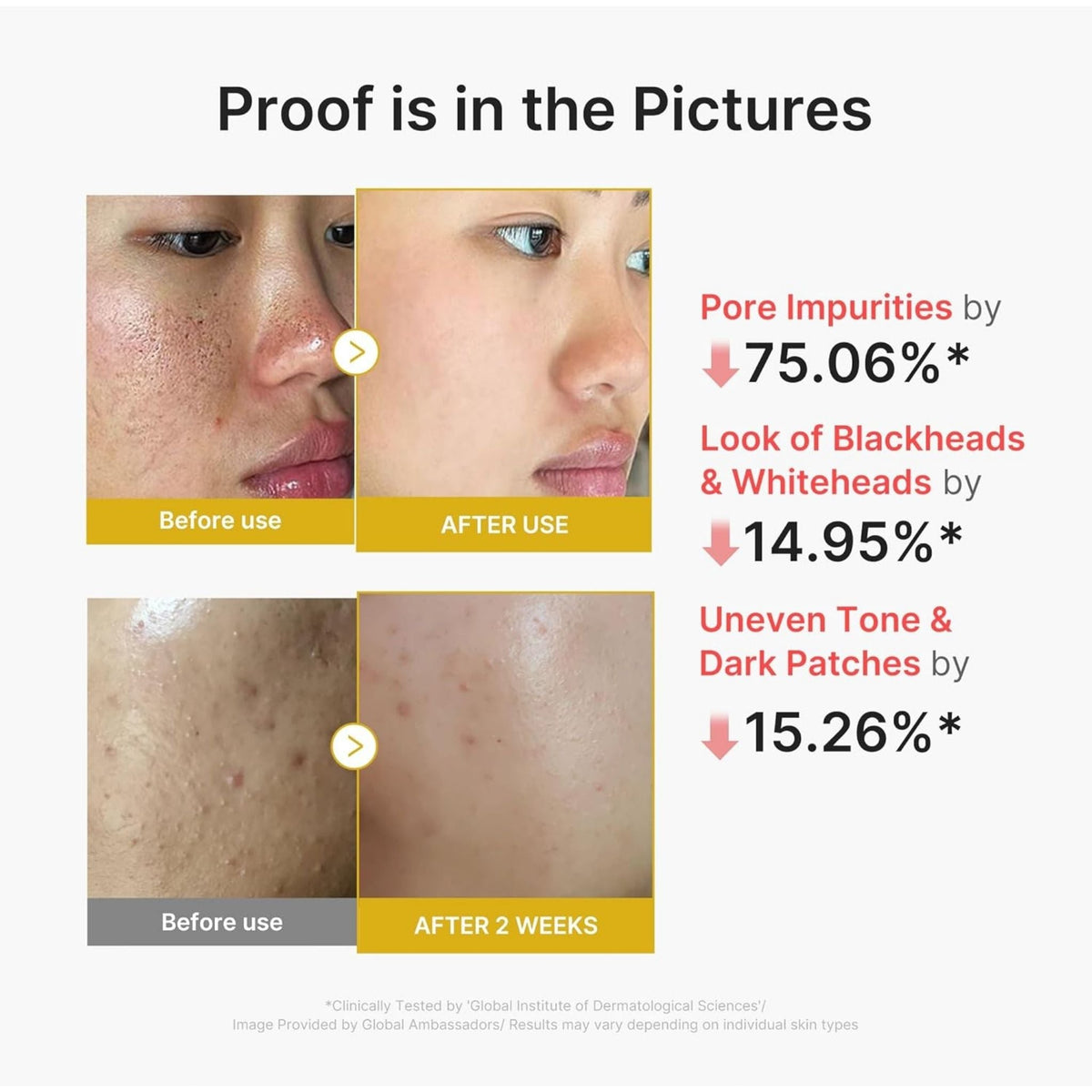 Refect Beauty Medicube Kojic Acid Turmeric Peel Shot before and after skin texture improvement results