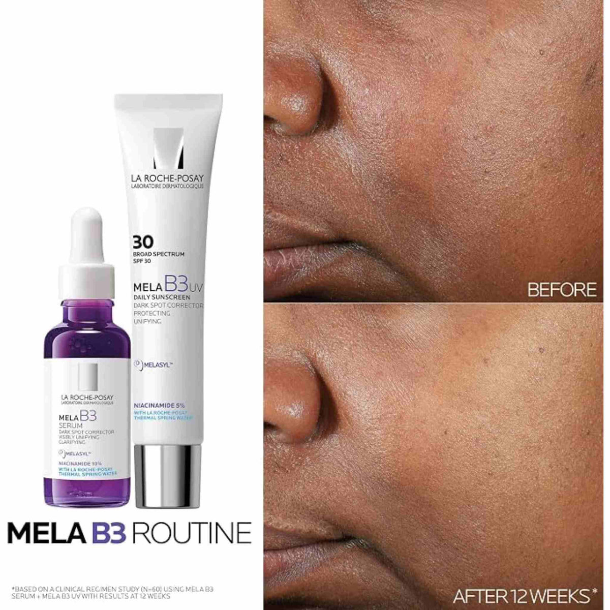 Refect Beauty La Roche-Posay Mela B3 serum and SPF 30 cream with before and after skin results showing reduced spots.