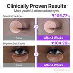 Refect Beauty Numbuzin No.9 eye cream before and after results showing reduced fine lines and brighter dark circles.