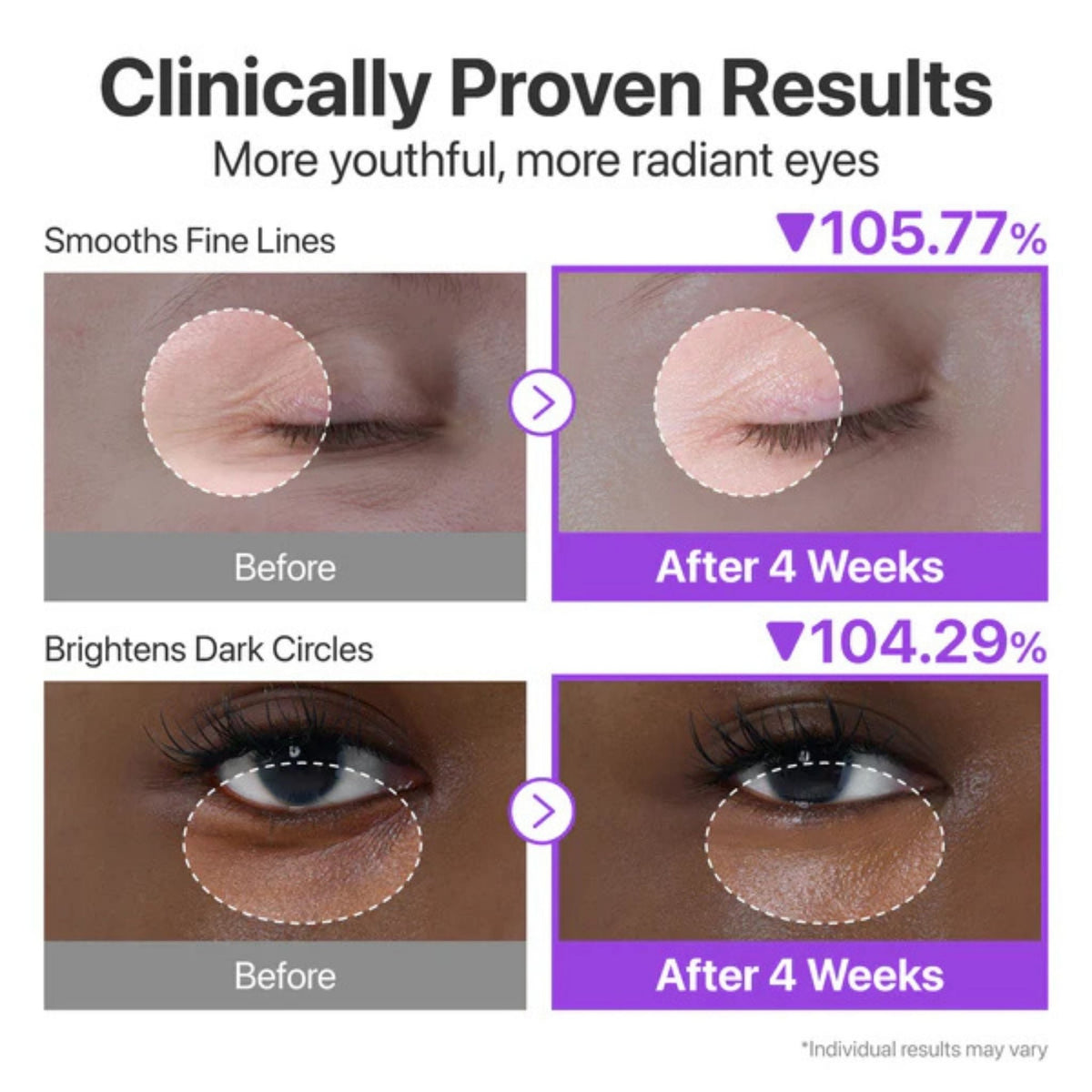 Refect Beauty Numbuzin No.9 eye cream before and after results showing reduced fine lines and brighter dark circles.
