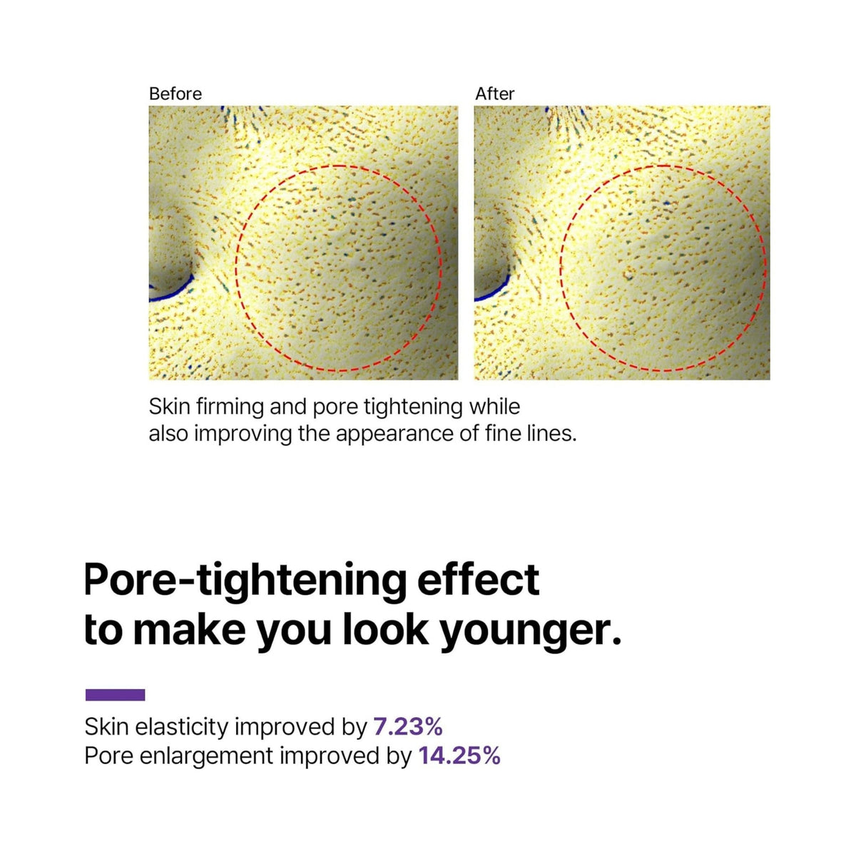 Refect Beauty Some By Mi Retinol eye cream before and after results showing improved skin texture and pore tightening