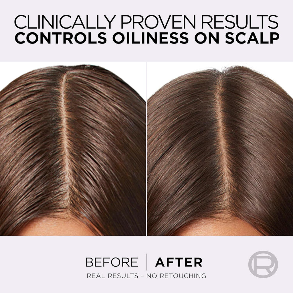 Refect Beauty before and after comparison showing reduced scalp oiliness after using L'Oreal Elvive Hyaluron conditioner