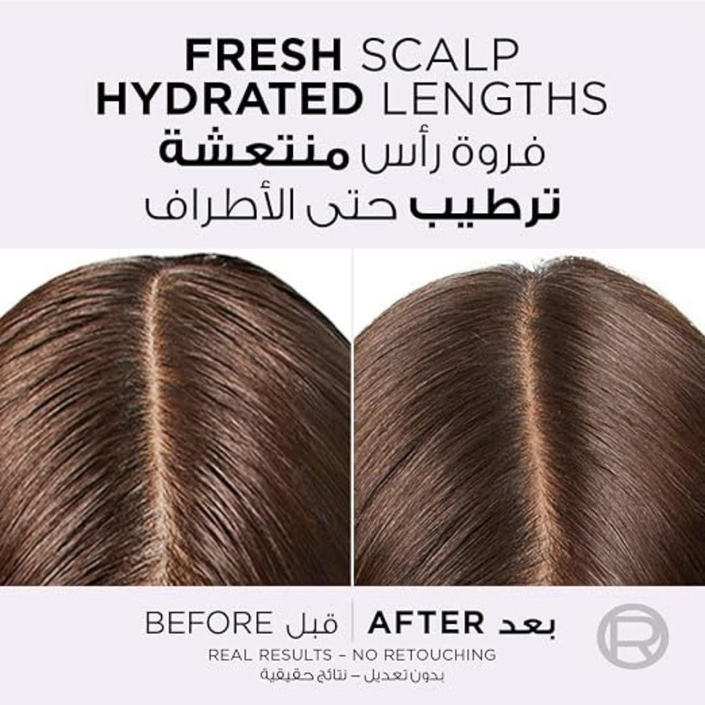 Refect Beauty before and after comparison of hair scalp showing cleaner roots and hydrated lengths after using serum