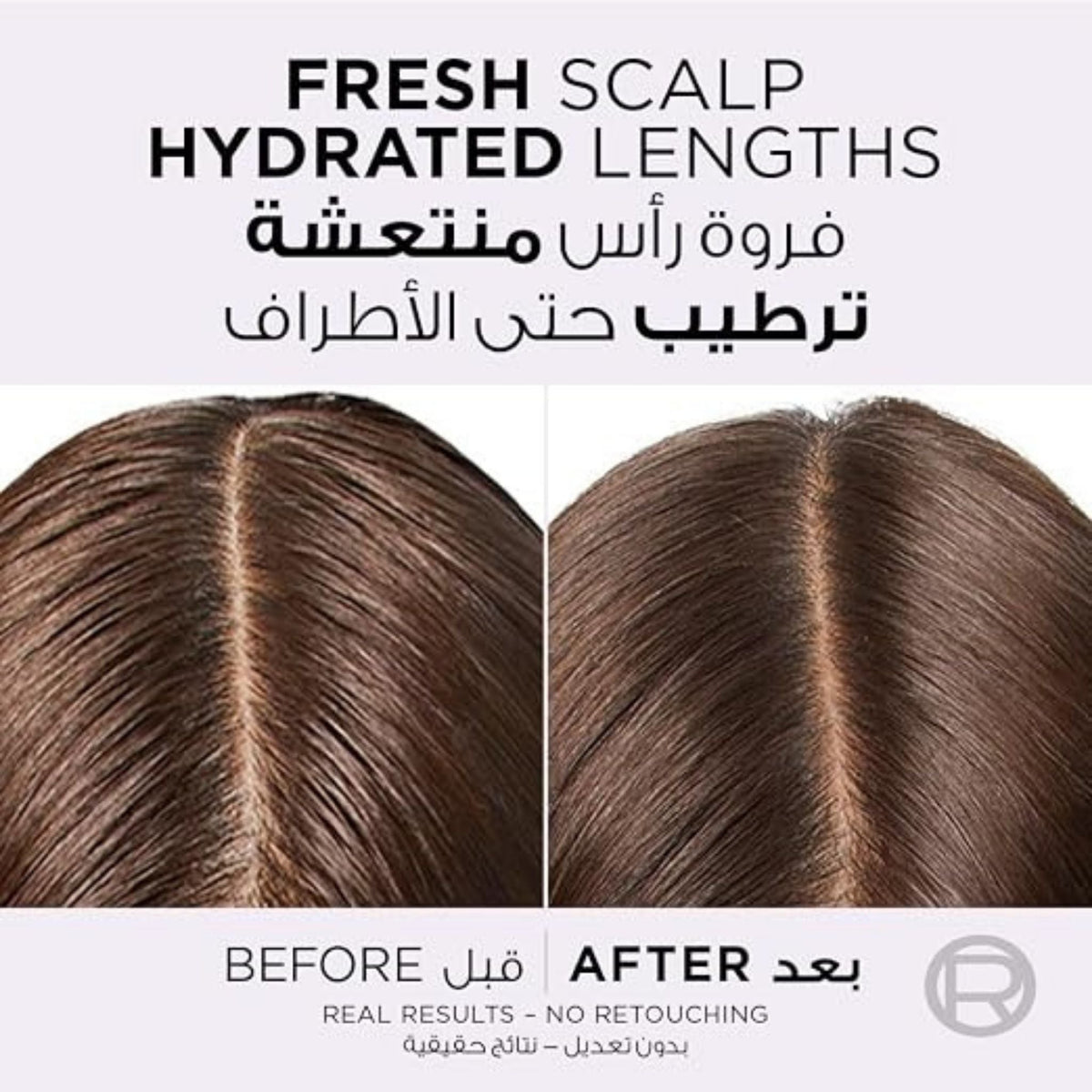 Refect Beauty before and after comparison of hair scalp showing cleaner roots and hydrated lengths after using serum