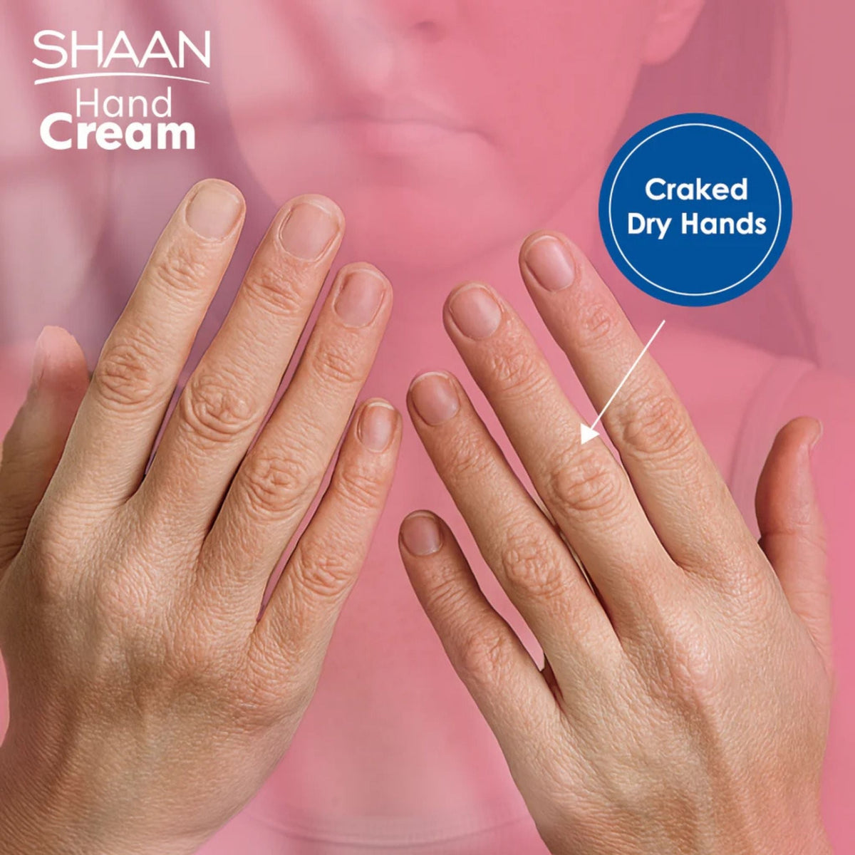 Refect Beauty Shaan Hand Cream applied to dry hands to relieve cracking and provide deep hydration