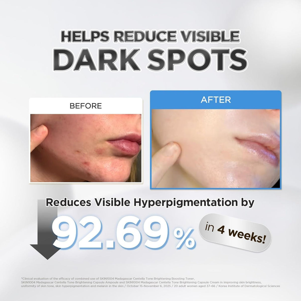 Refect Beauty comparison showing skin before and after using SKIN1004 Centella Tone Brightening Capsule Ampoule