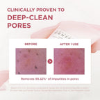 Refect Beauty clinical before and after results of SKIN1004 Centella Poremizing Deep Cleansing Foam on skin pores