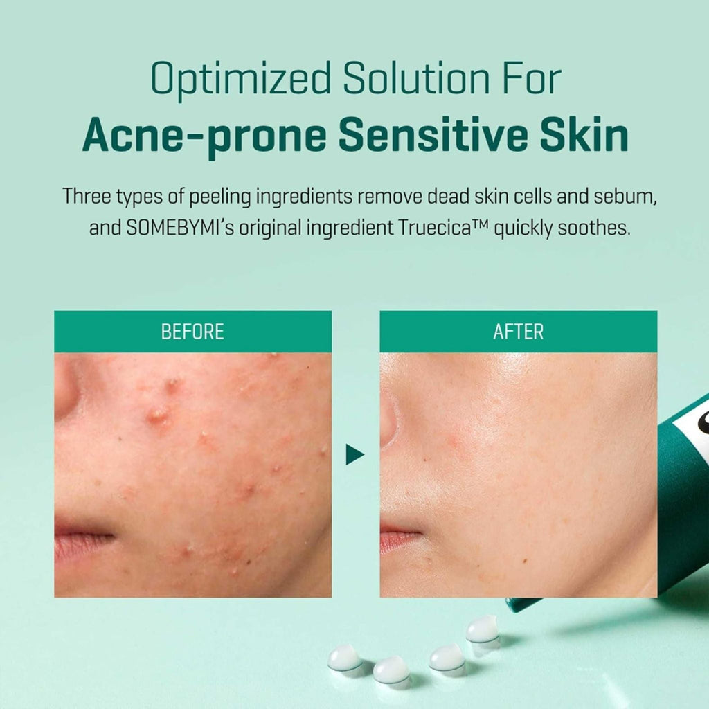 Refect Beauty Some By Mi acne spot cream before and after results showing clearer skin for blemish-prone sensitive skin