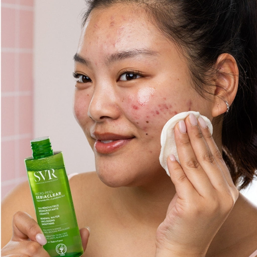 Refect Beauty model applying SVR Sebiaclear Micro-Peel exfoliating water to her face with a cotton pad