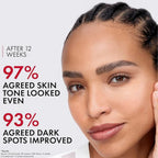 Refect Beauty model showing clear, radiant skin after 12 weeks of using Vichy Liftactiv B3 Dark Spots Serum