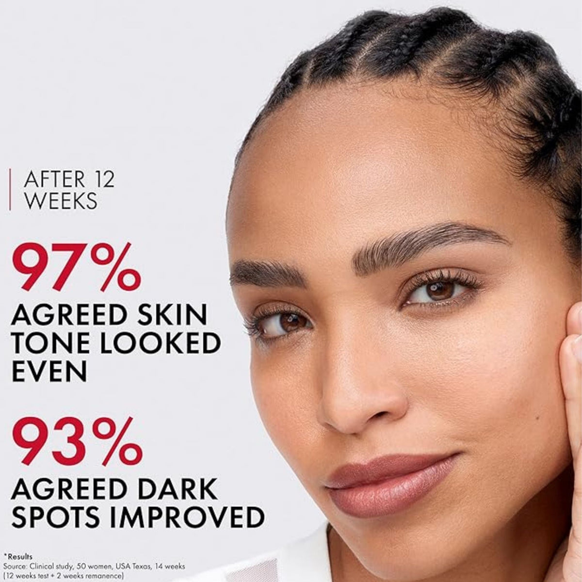 Refect Beauty model showing clear, radiant skin after 12 weeks of using Vichy Liftactiv B3 Dark Spots Serum