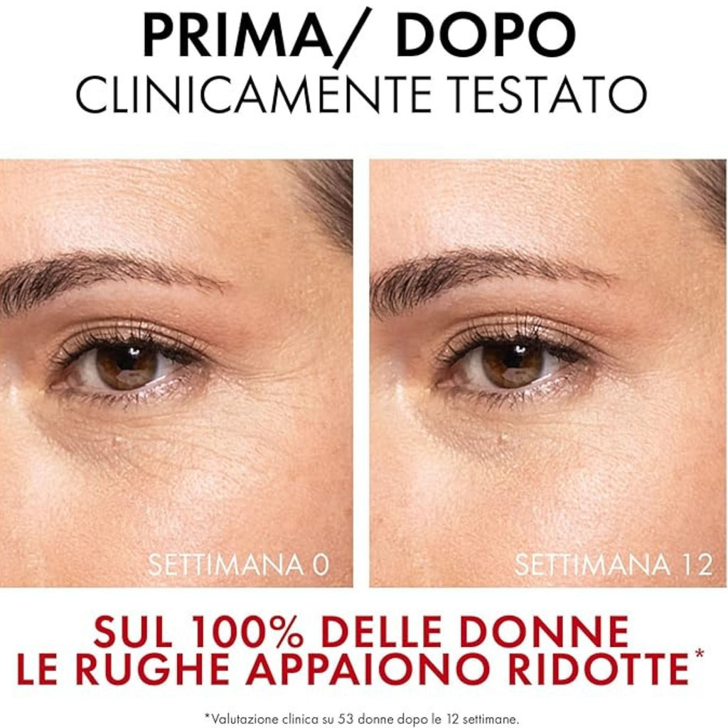 Refect Beauty before and after clinical results showing reduced eye wrinkles after 12 weeks of Vichy Liftactiv serum use