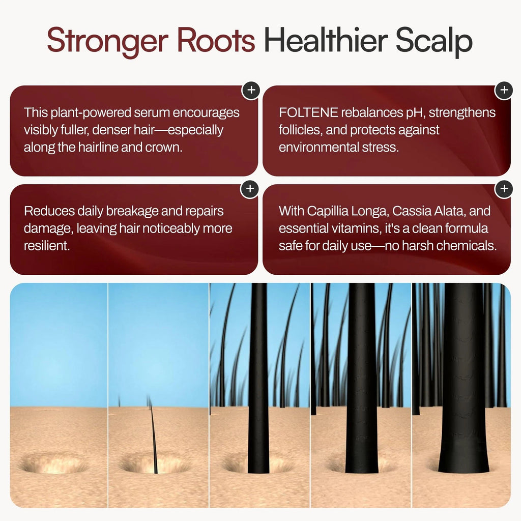 Foltene Hair & Scalp Treatment For Men